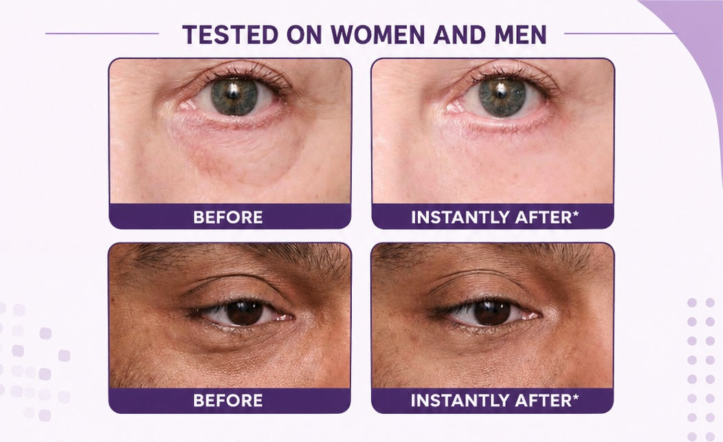 Instant Eye Tightener with Brush - Removes Eye Bags, Puffiness, Dark Circles & Fine Lines