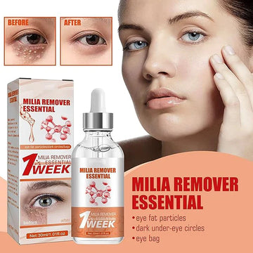 Milia Remover Essential 1 Week